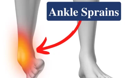 Symptoms of Ankle Sprains: How to Recognize and Treat Them