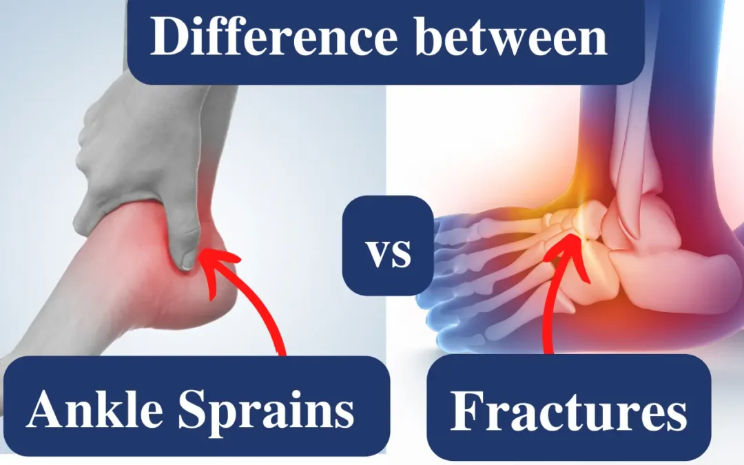 Difference between Ankle Sprains vs Fractures