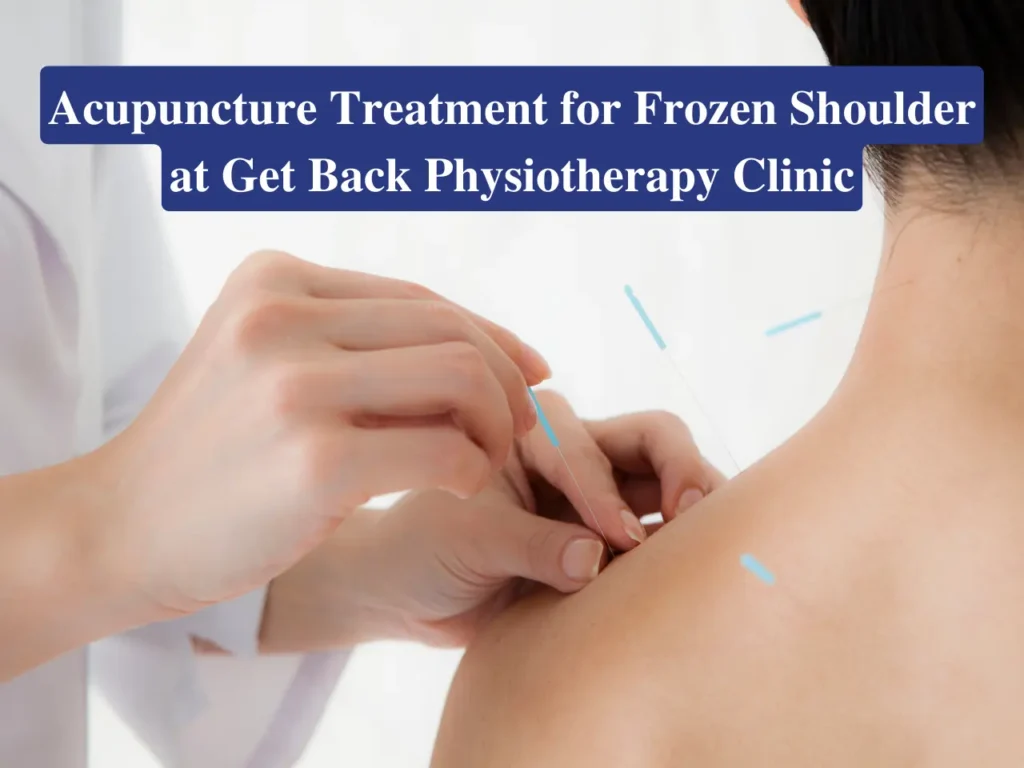 Acupuncture treatment for Frozen Shoulder