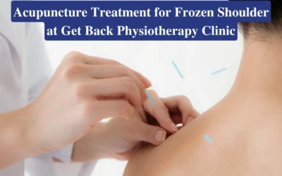Acupuncture Treatment for Frozen Shoulder